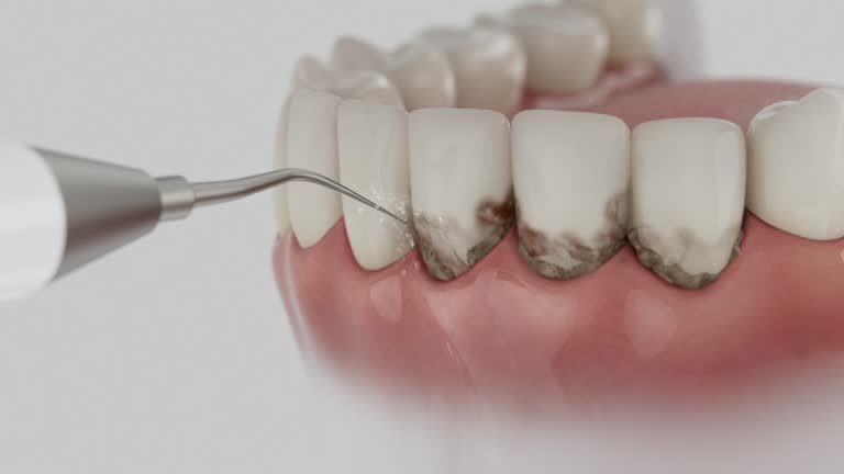 Reliable Dental Implants contractor in Dike, IA by Smile Center Dentistry